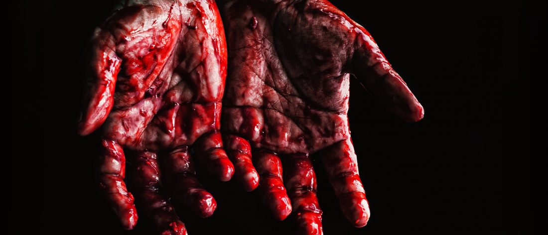 Bloody hands