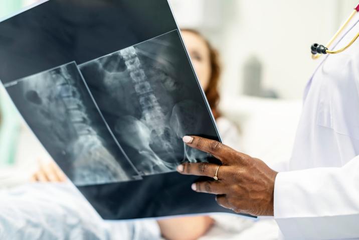 Doctor holding X-ray for health bones, not osteoporosis