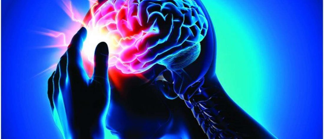 Brain experiencing a stroke