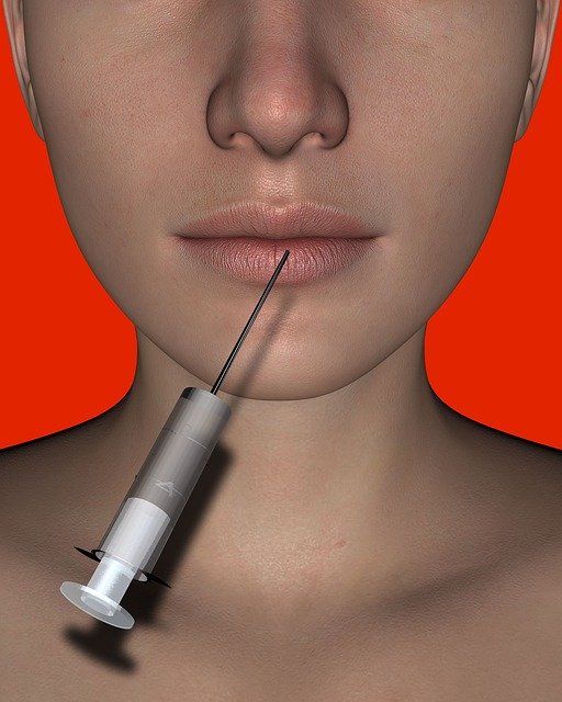 Lip Filler